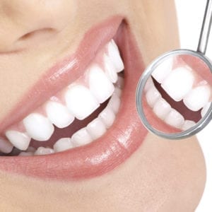 Caring For Your Smiles After Braces