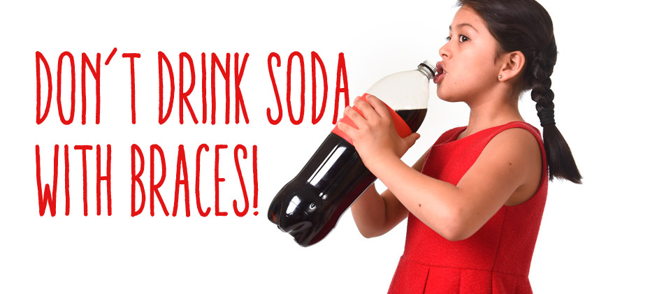 Can I drink soda with braces?